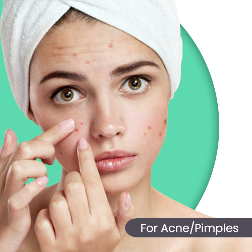 For Acne Pimples